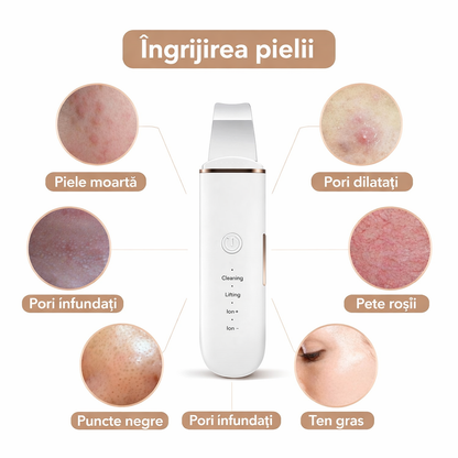 Aparat de Curățare Facială cu Ultrasunete, Curățare, Peeling, Hidratare și Lifting, 4 Moduri, Reîncărcabil USB, Alb