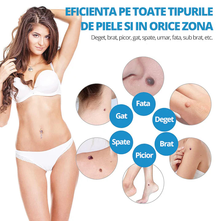 Dispozitiv indepartare papiloame LittleDomi kit skin tag fata gat corp 2 8 mm